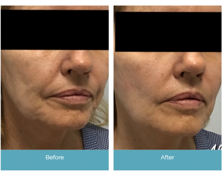 Before and After Treatments