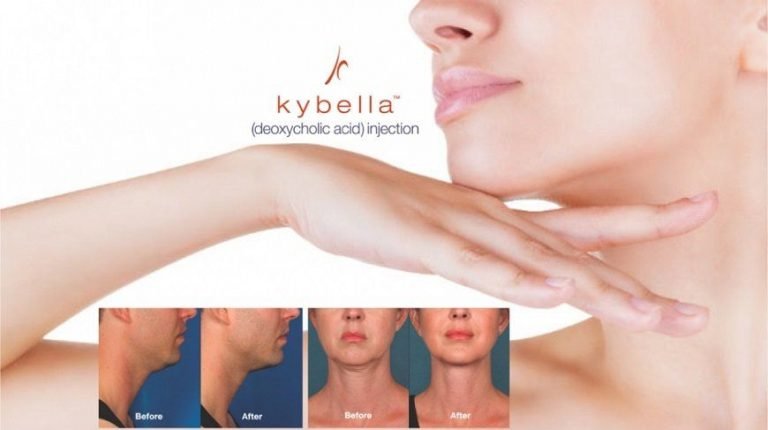 Lipodissolve Injection